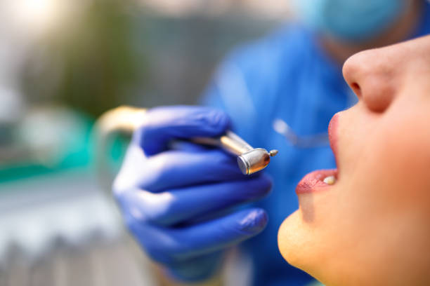 Best Veneers and Lumineers  in Rlsbad, CA